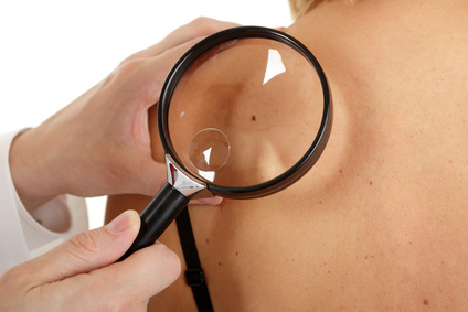 Skin Cancer Detection & Treatment